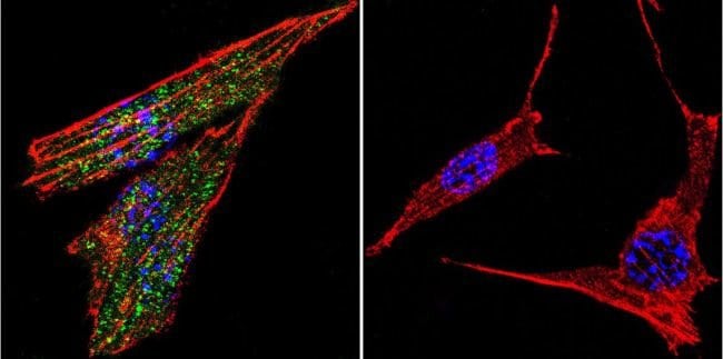 Glucocorticoid Receptor Polyclonal Antibody