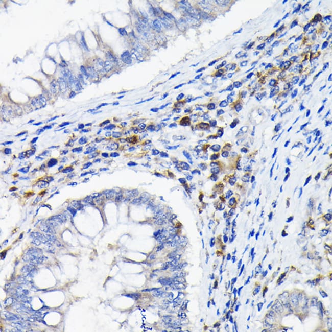 CD85k (Gp49b) Polyclonal Antibody