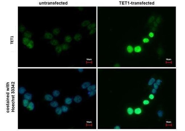 TET1 Monoclonal Antibody (GT1462)