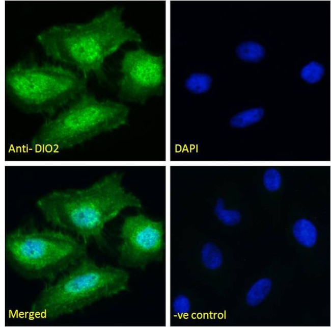 E-cadherin Monoclonal Antibody (ECCD-2)