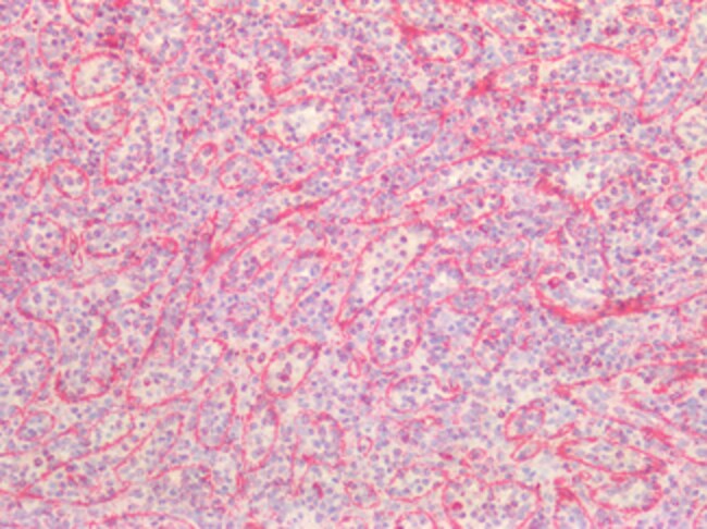 Vimentin Polyclonal Antibody