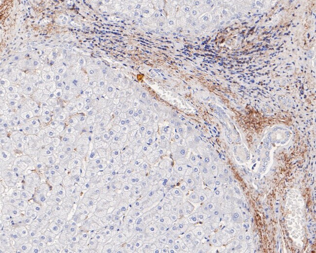 Vitronectin Recombinant Rabbit Monoclonal Antibody (ST49-02)