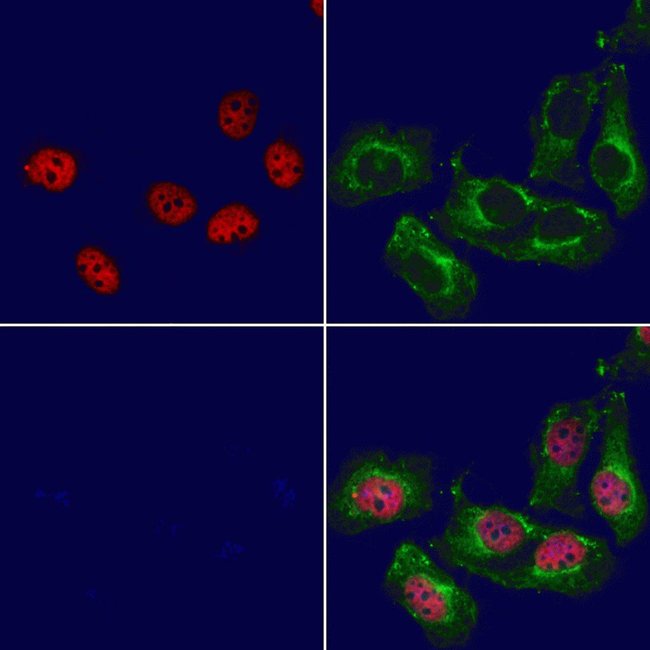 NeuroD2 Polyclonal Antibody