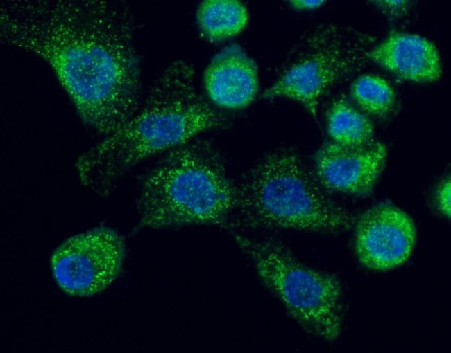 LAMP2 Polyclonal Antibody