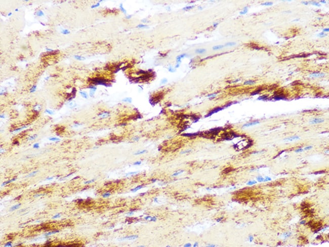 Myosin Heavy Chain Recombinant Rabbit Monoclonal Antibody (6V0G1)