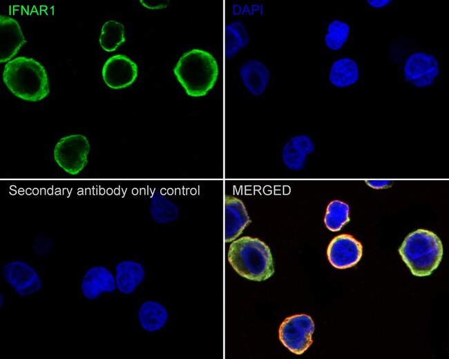 IFNAR1 Recombinant Rabbit Monoclonal Antibody (SR45-08)