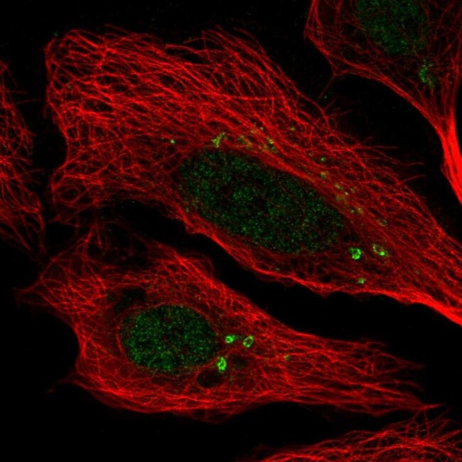 CEP112 Polyclonal Antibody