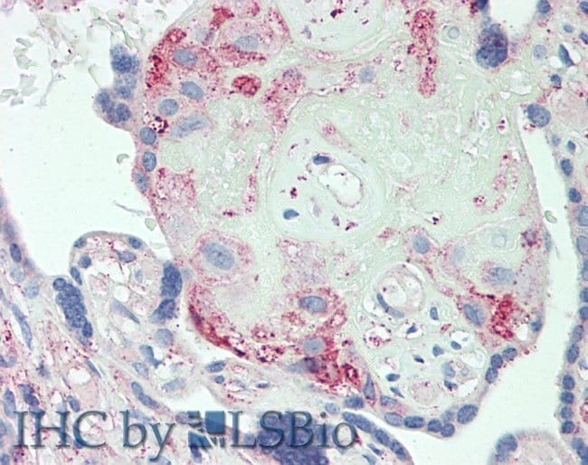 ORM2 Polyclonal Antibody