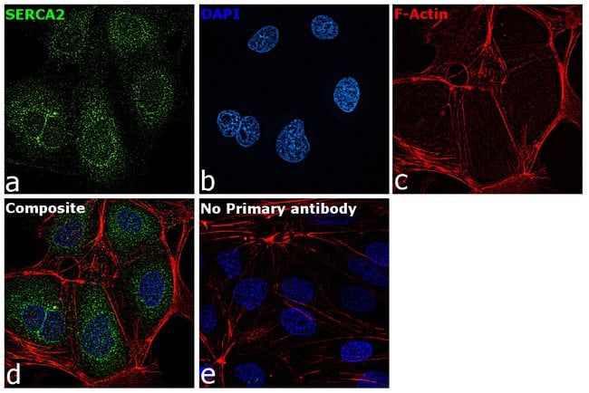 SERCA2 ATPase Monoclonal Antibody (IID8)