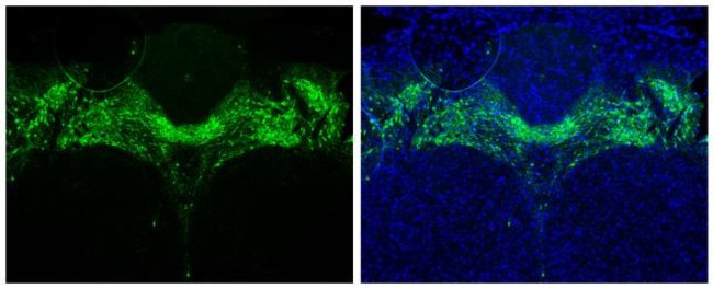 Tyrosine Hydroxylase Polyclonal Antibody