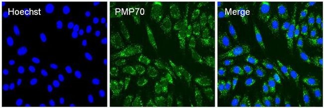 PMP70 Polyclonal Antibody