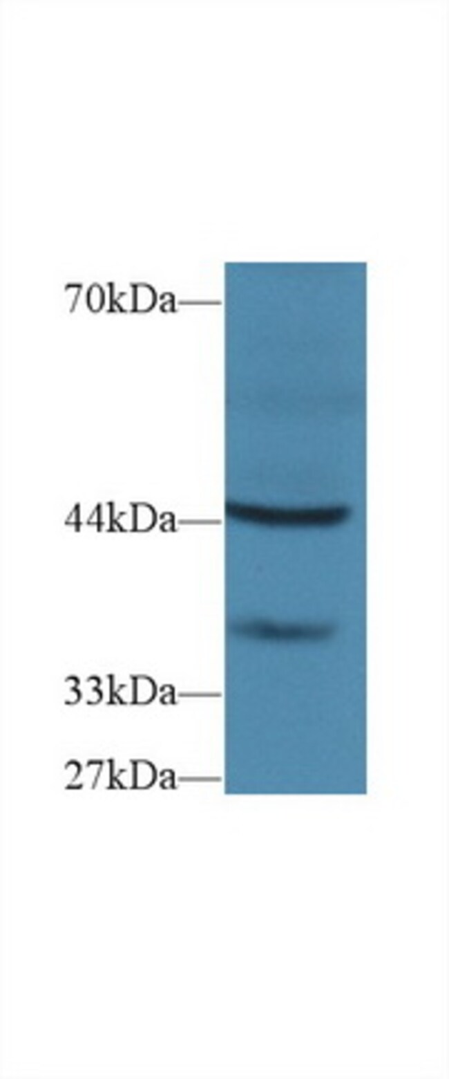 FBRS Polyclonal Antibody