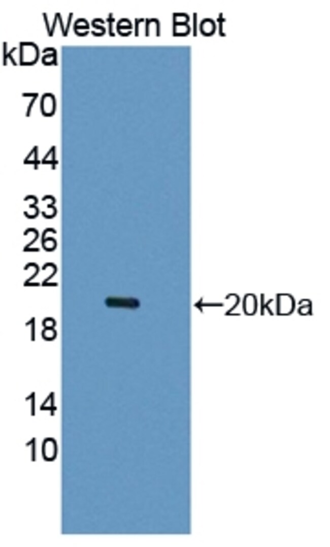 LECT2 Polyclonal Antibody