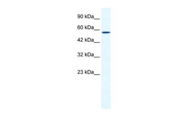 ZBTB44 Polyclonal Antibody