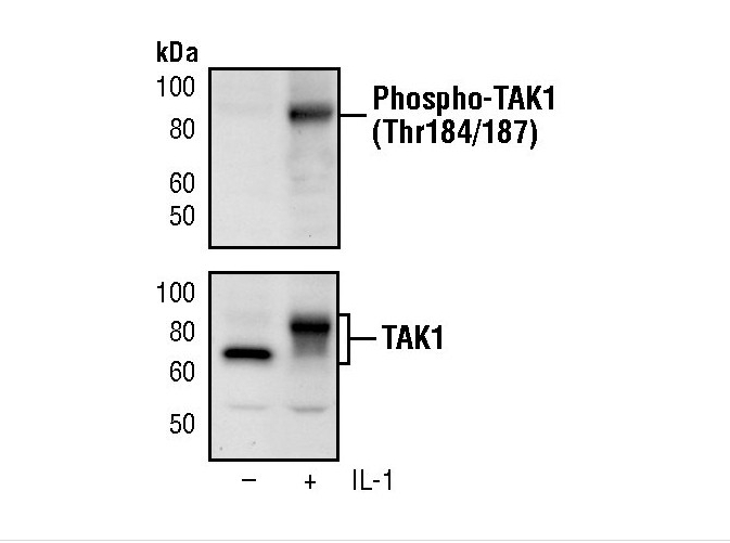 Phospho-TAK1 (Thr184, Thr187) Monoclonal Antibody (K.846.3