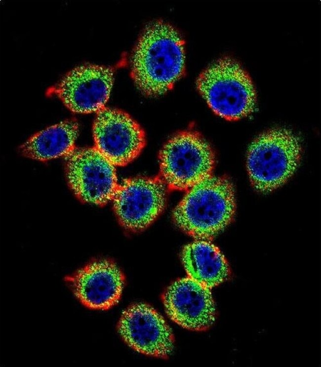 RASGRP2 Polyclonal Antibody