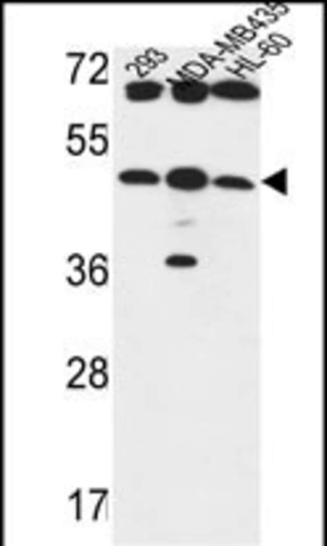 B3GNT5 Polyclonal Antibody
