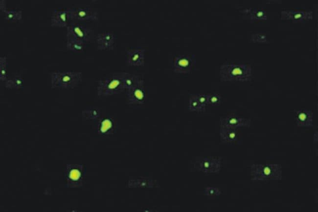 Ubiquitin Monoclonal Antibody (Ubi-1)