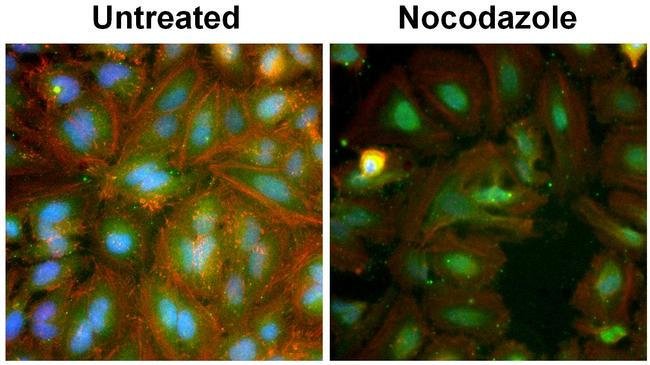 MDM2 Monoclonal Antibody (IF2)