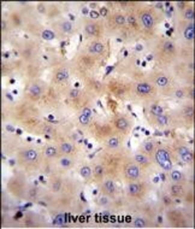 FBXO47 Polyclonal Antibody