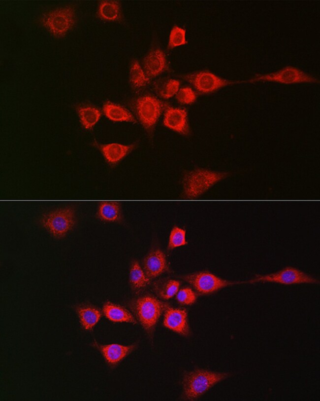 METTL4 Polyclonal Antibody