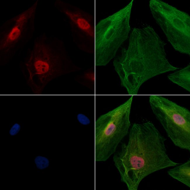 PPP2R5C Polyclonal Antibody