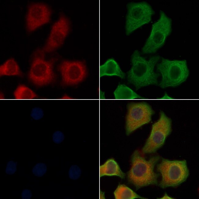 IL4R Polyclonal Antibody