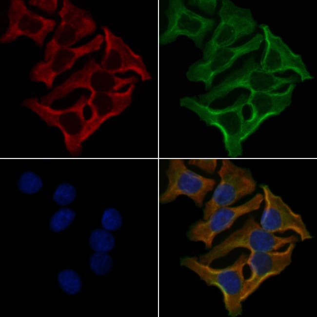OR2M7 Polyclonal Antibody