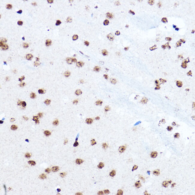 SETD5 Polyclonal Antibody
