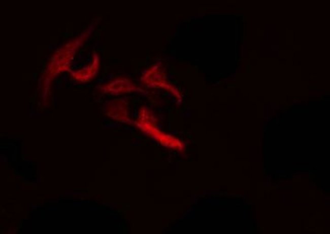 PTHLH Polyclonal Antibody
