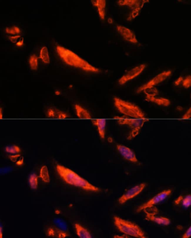 LRRC7 Polyclonal Antibody