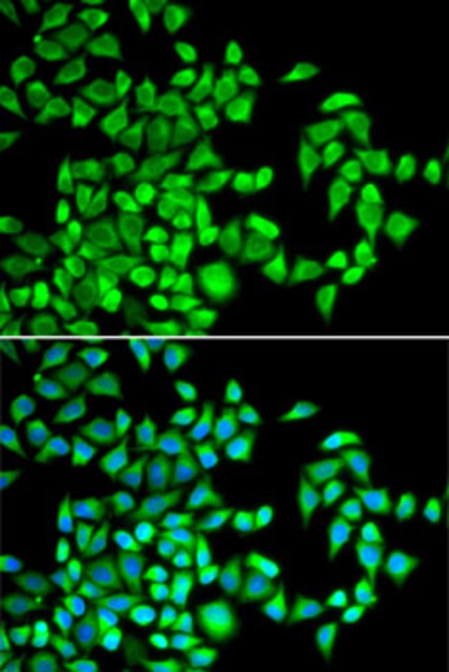 ABH1 Polyclonal Antibody
