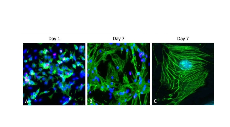 Cardiac Troponin T Monoclonal Antibody (13-11)