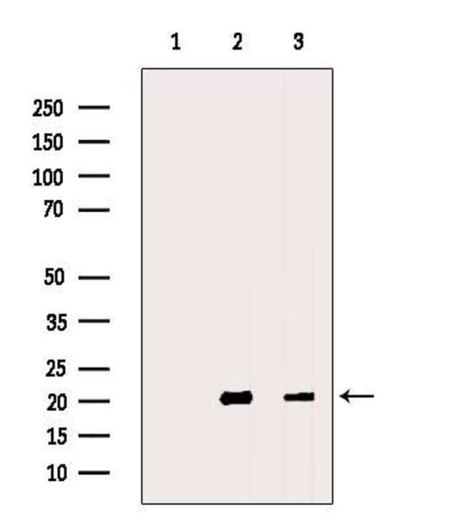 MFAP5 Polyclonal Antibody