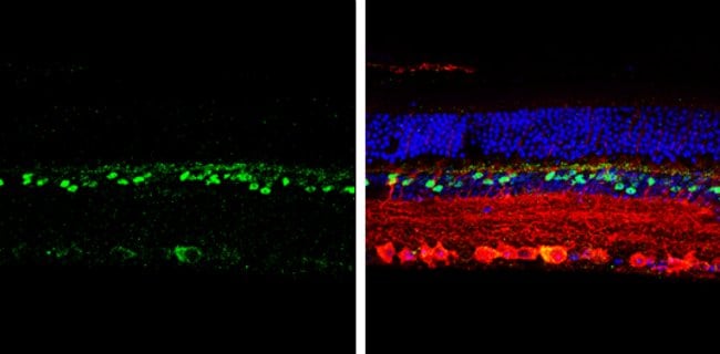 CHX10 Polyclonal Antibody