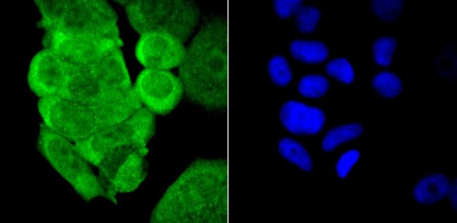 PCBP1 Polyclonal Antibody