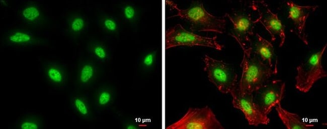 NFYB Polyclonal Antibody
