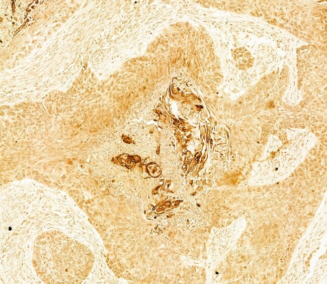 Collagen II Polyclonal Antibody