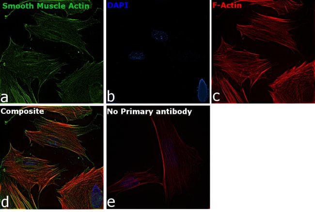 Alpha-Smooth Muscle Actin Monoclonal Antibody (1A4)