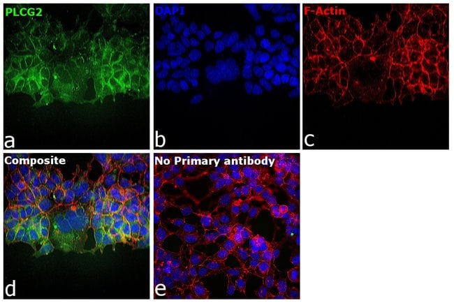 Sodium Potassium ATPase Recombinant Rabbit Monoclonal Antibody (ST0533)