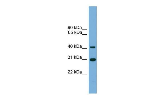 C1orf51 Polyclonal Antibody