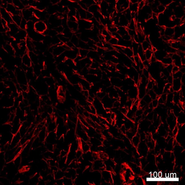 Alpha-Smooth Muscle Actin Monoclonal Antibody (1A4), eFluor 660, eBioscience