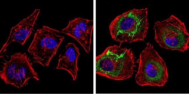 Thrombospondin 1 Monoclonal Antibody (A6.1)
