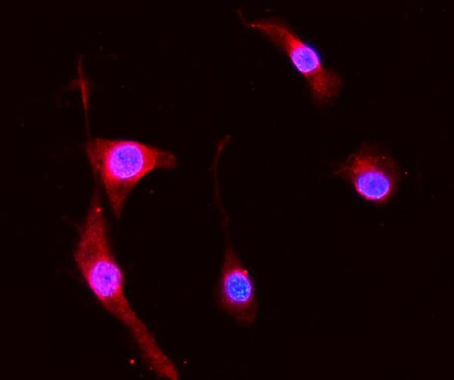 S100A8 Polyclonal Antibody