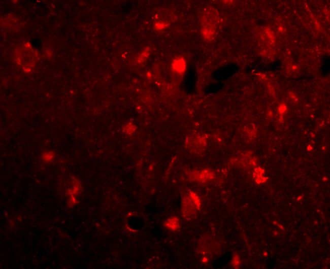 SLITRK2 Polyclonal Antibody