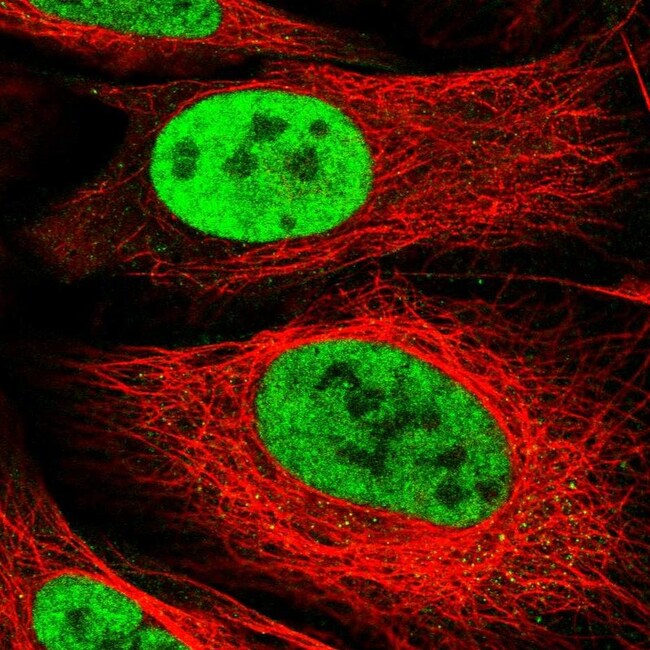 ARS2 Polyclonal Antibody