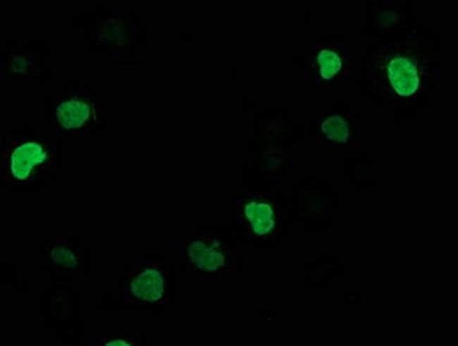 SSX1 Monoclonal Antibody (OTI2F8)