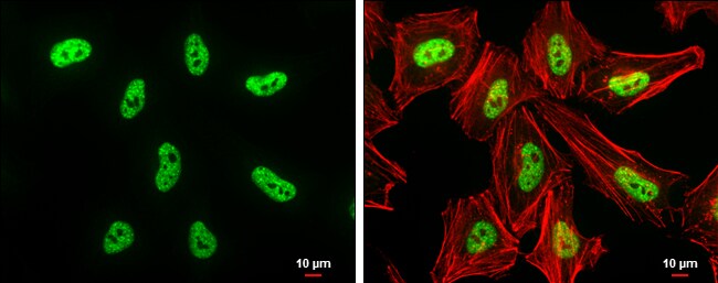 DNMT3B Polyclonal Antibody