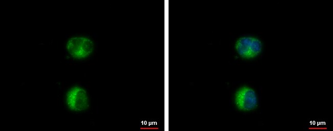 HEATR2 Polyclonal Antibody