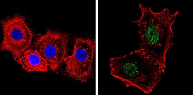 NCoR1 Polyclonal Antibody